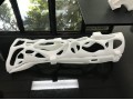 3D打印机制造模型如何改善骨折治疗